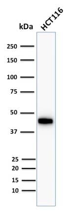Cytokeratin 18 Antibody (Cocktail) - IHC-Prediluted Western Blot: Cytokeratin 18 Antibody (Cocktail) - IHC-Prediluted [NBP2-48076] -