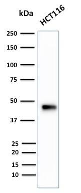Cytokeratin 18 Antibody (B23.1) - IHC-Prediluted Western Blot: Cytokeratin 18 Antibody (B23.1) - IHC-Prediluted [NBP2-48085] -