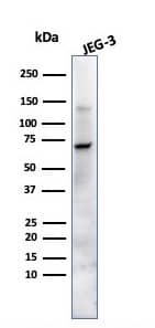 Alkaline Phosphatase/ALPP Antibody (ALP/870) - IHC-Prediluted Western Blot: Alkaline Phosphatase/ALPP Antibody (ALP/870) - IHC-Prediluted [NBP2-48092] -