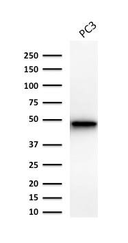 Cytokeratin 19 Antibody (Ks19.1) - IHC-Prediluted Western Blot: Cytokeratin 19 Antibody (Ks19.1) - IHC-Prediluted [NBP2-48096] -