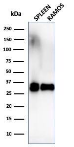 HLA DRB1 Antibody (SPM289) - IHC-Prediluted Western Blot: HLA DRB1 Antibody (SPM289) - IHC-Prediluted [NBP2-48113] -