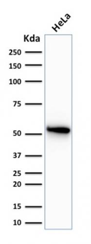 Cytokeratin 7 Antibody (OV-TL12/30) - IHC-Prediluted Western Blot: Cytokeratin 7 Antibody (OV-TL12/30) - IHC-Prediluted [NBP2-48115] -