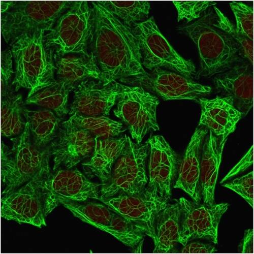 Cytokeratin 7 Antibody (OV-TL12/30) - IHC-Prediluted Immunocytochemistry/ Immunofluorescence: Cytokeratin 7 Antibody (OV-TL12/30) - IHC-Prediluted [NBP2-48115] -