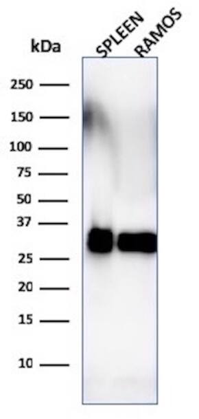 HLA DRB1 Antibody (SPM288) - IHC-Prediluted Western Blot: HLA DRB1 Antibody (SPM288) - IHC-Prediluted [NBP2-48122] -