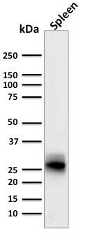 HLA DRB1 Antibody (SPM423) - IHC-Prediluted Western Blot: HLA DRB1 Antibody (SPM423) - IHC-Prediluted [NBP2-48123] -