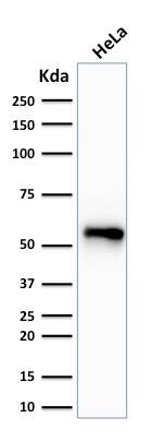 Cytokeratin 7 Antibody (SPM270) - IHC-Prediluted Western Blot: Cytokeratin 7 Antibody (SPM270) - IHC-Prediluted [NBP2-48124] -