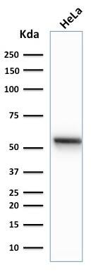 Cytokeratin 7 Antibody (K72.7) - IHC-Prediluted Western Blot: Cytokeratin 7 Antibody (K72.7) - IHC-Prediluted [NBP2-48125] -