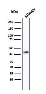 alpha-Methylacyl-CoA Racemase/AMACR Antibody - IHC-Prediluted Western Blot: alpha-Methylacyl-CoA Racemase/AMACR Antibody - IHC-Prediluted [NBP2-48130] -