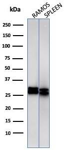 HLA DRB1 Antibody (HLA-DRB/1067) - IHC-Prediluted Western Blot: HLA DRB1 Antibody (HLA-DRB/1067) - IHC-Prediluted [NBP2-48135] -