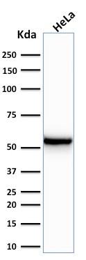 Cytokeratin 7 Antibody (KRT7/760) - IHC-Prediluted Western Blot: Cytokeratin 7 Antibody (KRT7/760) - IHC-Prediluted [NBP2-48140] -