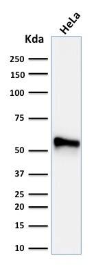 Cytokeratin 7 Antibody (KRT7/760 + KRT7/903) - IHC-Prediluted Western Blot: Cytokeratin 7 Antibody (KRT7/760 + KRT7/903) - IHC-Prediluted [NBP2-48143] -