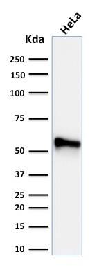 Cytokeratin 7 Antibody (KRT7/760 + OV-TL12/30) - IHC-Prediluted Western Blot: Cytokeratin 7 Antibody (KRT7/760 + OV-TL12/30) - IHC-Prediluted [NBP2-48144] -