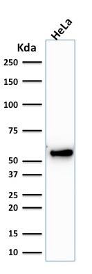 Cytokeratin 7 Antibody (KRT7/1198) - IHC-Prediluted Western Blot: Cytokeratin 7 Antibody (KRT7/1198) - IHC-Prediluted [NBP2-48145] -