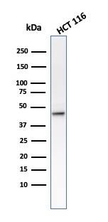 Cytokeratin 8 Antibody (B22.1) - IHC-Prediluted Western Blot: Cytokeratin 8 Antibody (B22.1) - IHC-Prediluted [NBP2-48146] -