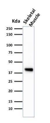 Actin (Muscle Specific) Antibody (HHF35) - IHC-Prediluted Western Blot: Actin (Muscle Specific) Antibody (HHF35) - IHC-Prediluted [NBP2-48154] -