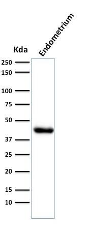 Actin (Muscle Specific) Antibody (HHF35) - IHC-Prediluted Western Blot: Actin (Muscle Specific) Antibody (HHF35) - IHC-Prediluted [NBP2-48154] -