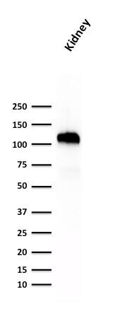 Cadherin-16 Antibody (SPM594) - IHC-Prediluted Western Blot: Cadherin-16 Antibody (SPM594) - IHC-Prediluted [NBP2-48155] -