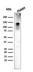 Caldesmon/CALD1 Antibody (h-CALD) - IHC-Prediluted Western Blot: Caldesmon/CALD1 Antibody (h-CALD) - IHC-Prediluted [NBP2-48156] -