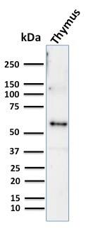 Cytokeratin 10 Antibody (KRT10/844) - IHC-Prediluted Western Blot: Cytokeratin 10 Antibody (KRT10/844) - IHC-Prediluted [NBP2-48167] -