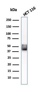 Cytokeratin 8 Antibody (KRT8/803) - IHC-Prediluted Western Blot: Cytokeratin 8 Antibody (KRT8/803) - IHC-Prediluted [NBP2-48170] -