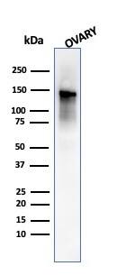Caldesmon/CALD1 Antibody (SPM168) - IHC-Prediluted Western Blot: Caldesmon/CALD1 Antibody (SPM168) - IHC-Prediluted [NBP2-48181] -