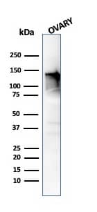 Caldesmon/CALD1 Antibody (CALD1/820) - IHC-Prediluted Western Blot: Caldesmon/CALD1 Antibody (CALD1/820) - IHC-Prediluted [NBP2-48182] -