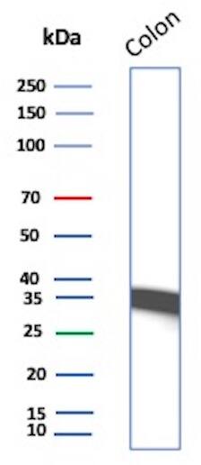 Calponin 1 Antibody (CALP) - IHC-Prediluted Western Blot: Calponin 1 Antibody (CALP) - IHC-Prediluted [NBP2-48184] -
