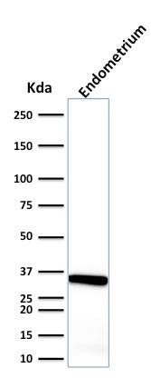 Calponin 1 Antibody (CALP) - IHC-Prediluted Western Blot: Calponin 1 Antibody (CALP) - IHC-Prediluted [NBP2-48184] -