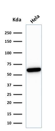 HSP60 Antibody (HSPD1/780) - IHC-Prediluted Western Blot: HSP60 Antibody (HSPD1/780) - IHC-Prediluted [NBP2-48187] -
