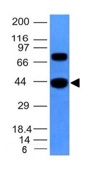 Actin (Muscle Specific) Antibody (MSA/953) - IHC-Prediluted Western Blot: Actin (Muscle Specific) Antibody (MSA/953) - IHC-Prediluted [NBP2-48189] -