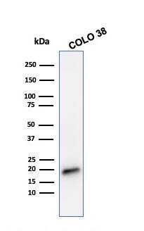 Melan-A/MART-1 Antibody (MLANA/788) - IHC-Prediluted Western Blot: Melan-A/MART-1 Antibody (MLANA/788) - IHC-Prediluted [NBP2-48209] -