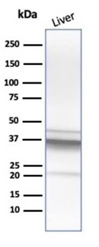 Arginase 1/ARG1/liver Arginase Antibody (ARG1/1125) - IHC-Prediluted Western Blot: Arginase 1/ARG1/liver Arginase Antibody (ARG1/1125) - IHC-Prediluted [NBP2-48229] -