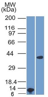 Arginase 1/ARG1/liver Arginase Antibody (ARG1/1125) - IHC-Prediluted Western Blot: Arginase 1/ARG1/liver Arginase Antibody (ARG1/1125) - IHC-Prediluted [NBP2-48229] -