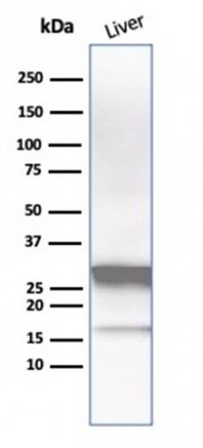 Arginase 1/ARG1/liver Arginase Antibody (ARG1/1126) - IHC-Prediluted Western Blot: Arginase 1/ARG1/liver Arginase Antibody (ARG1/1126) - IHC-Prediluted [NBP2-48230] -