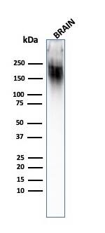 NF-H Antibody (SPM203) - IHC-Prediluted Western Blot: NF-H Antibody (SPM203) - IHC-Prediluted [NBP2-48236] -