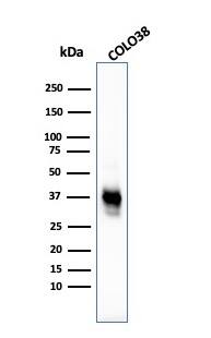 Melanoma Marker (MART-1 + Tyrosinase + gp100) Antibody (M2-7C10 + M2-9E3 + T311 + HMB45) - IHC-Prediluted Western Blot: Melanoma Marker (MART-1 + Tyrosinase + gp100) Antibody (M2-7C10 + M2-9E3 + T311 + HMB45) - IHC-Prediluted [NBP2-48257] -