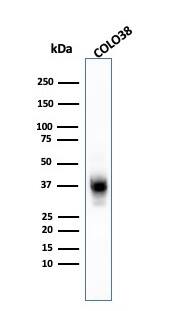 Melanoma Marker (MART-1 + Tyrosinase + gp100) Antibody (A103 + T311 + HMB45) - IHC-Prediluted Western Blot: Melanoma Marker (MART-1 + Tyrosinase + gp100) Antibody (A103 + T311 + HMB45) - IHC-Prediluted [NBP2-48258] -