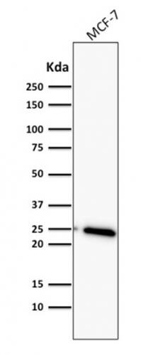 Bcl-2 Antibody (BCL2/782) - IHC-Prediluted Western Blot: Bcl-2 Antibody (BCL2/782) - IHC-Prediluted [NBP2-48277] -