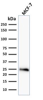 Bcl-2 Antibody (BCL2/796) - IHC-Prediluted Western Blot: Bcl-2 Antibody (BCL2/796) - IHC-Prediluted [NBP2-48278] -
