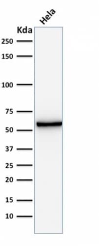 Mitochondria Antibody (AE-1) - IHC-Prediluted Western Blot: Mitochondria Antibody (AE-1) - IHC-Prediluted [NBP2-48282] -