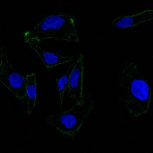 EpCAM/TROP1 Antibody (EGP40/837) - (ECD) - IHC-Prediluted Immunocytochemistry/ Immunofluorescence: EpCAM/TROP1 Antibody (EGP40/837) - (ECD) - IHC-Prediluted [NBP2-48289] -