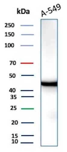 Isocitrate Dehydrogenase 1/IDH1 Antibody (IDH1/1152) - IHC-Prediluted Western Blot: Isocitrate Dehydrogenase 1/IDH1 Antibody (IDH1/1152) - IHC-Prediluted [NBP2-48302] -