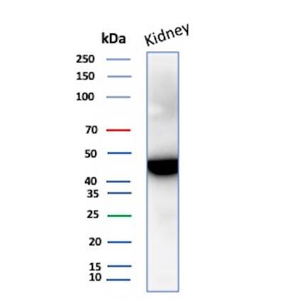 Isocitrate Dehydrogenase 1/IDH1 Antibody (IDH1/1152) - IHC-Prediluted Western Blot: Isocitrate Dehydrogenase 1/IDH1 Antibody (IDH1/1152) - IHC-Prediluted [NBP2-48302] -
