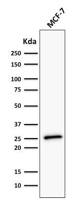 Bcl-2 Antibody (BCL2/782 + BCL2/796) - IHC-Prediluted Western Blot: Bcl-2 Antibody (BCL2/782 + BCL2/796) - IHC-Prediluted [NBP2-48303] -
