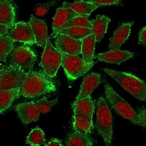 Moesin Antibody (MSN/492) - IHC-Prediluted Immunocytochemistry/ Immunofluorescence: Moesin Antibody (MSN/492) - IHC-Prediluted [NBP2-48305] -