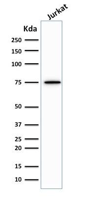 Moesin Antibody (MSN/492) - IHC-Prediluted Western Blot: Moesin Antibody (MSN/492) - IHC-Prediluted [NBP2-48305] -