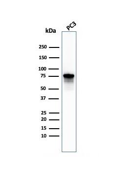 Moesin Antibody (MSN/492) - IHC-Prediluted Western Blot: Moesin Antibody (MSN/492) - IHC-Prediluted [NBP2-48305] -