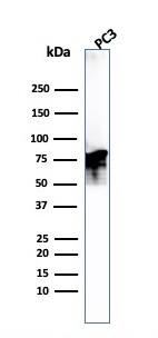 Moesin Antibody (MSN/493) - IHC-Prediluted Western Blot: Moesin Antibody (MSN/493) - IHC-Prediluted [NBP2-48306] -
