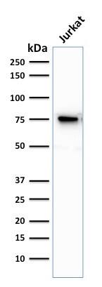 Moesin Antibody (MSN/493) - IHC-Prediluted Western Blot: Moesin Antibody (MSN/493) - IHC-Prediluted [NBP2-48306] -