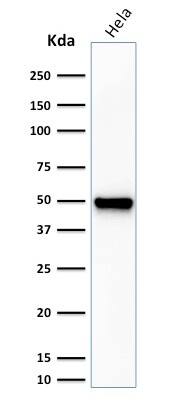 Fascin Antibody (FSCN1/416) - IHC-Prediluted Western Blot: Fascin Antibody (FSCN1/416) - IHC-Prediluted [NBP2-48310] -